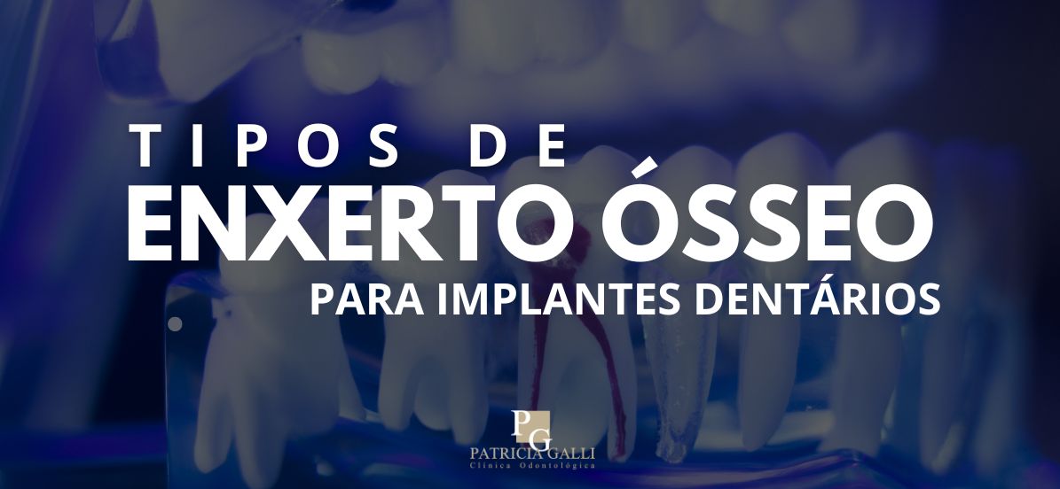 Enxerto ósseo para implantes dentários
