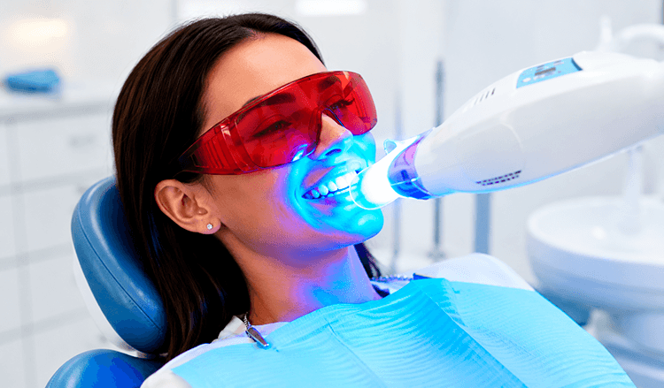 Clareamento dental realizado em consultório odontológico