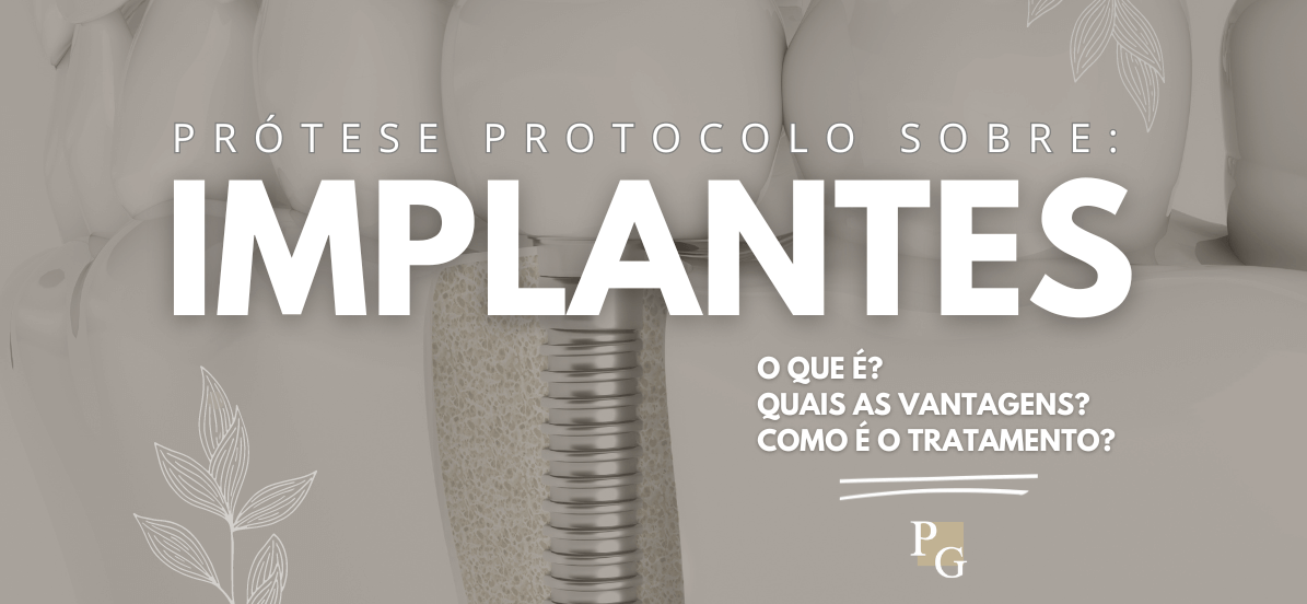 Prótese protocolo sobre implantes