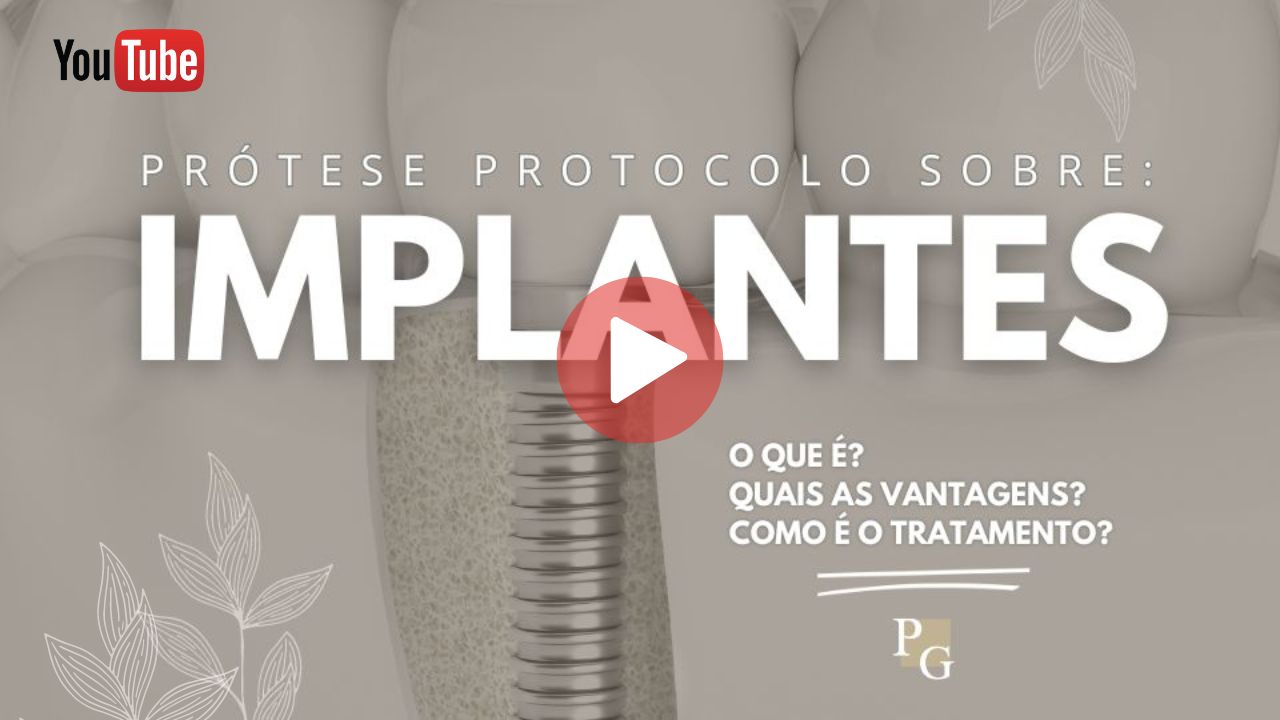 Vídeo sobre prótese protocolo sobre implantes dentários