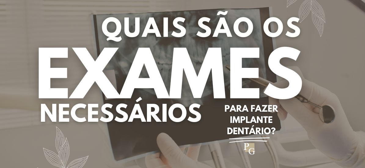 Quais são os exames necessários para fazer implante dentário